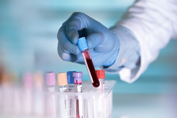 Test avant la chirurgie