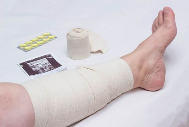 conséquences possibles après la chirurgie